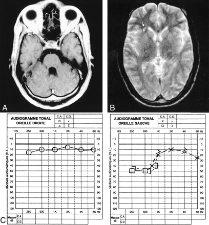 Fig 3.
