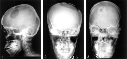Fig 2.