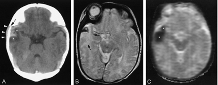 Fig 1.