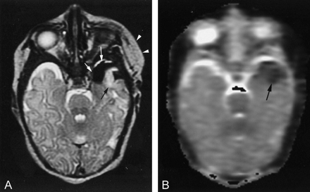 Fig 2.