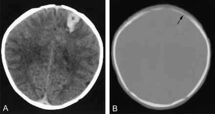 Fig 4.