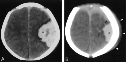 Fig 5.