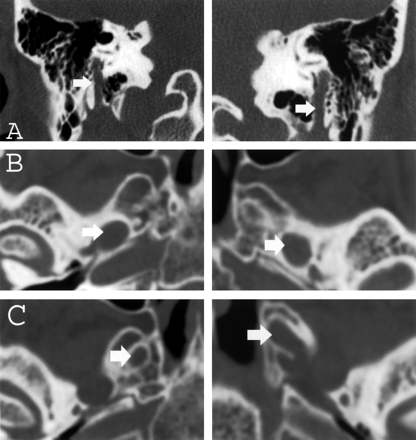 Fig 2.