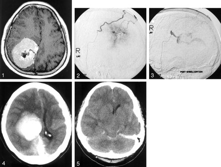 Fig 2.