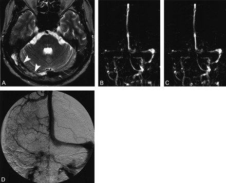 Fig 6.