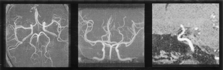 Fig 4.