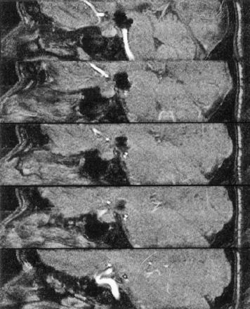 Fig 9.