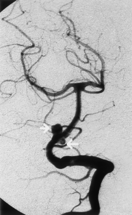 Fig 1.