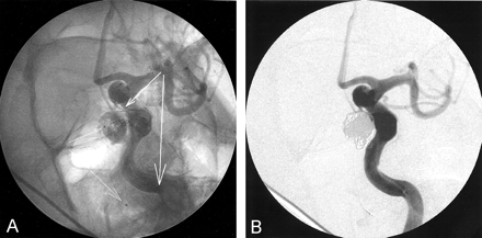 Fig 4.
