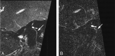 Fig 5.