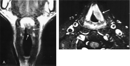 Fig 2.