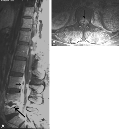 Fig 2.
