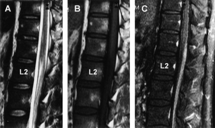Fig 2.