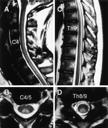 Fig 3.