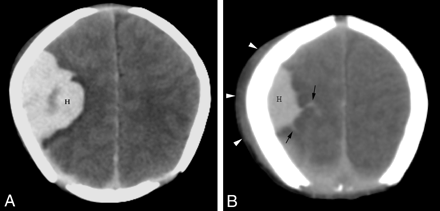 Fig 5.