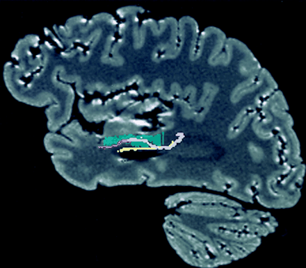 Fig 16.