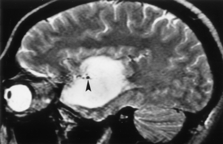 Fig 8.