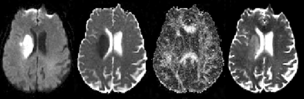 Fig 4.