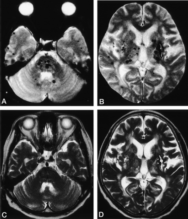 Fig 1.