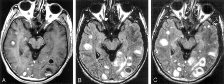 Fig 1.