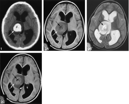 Fig 2.