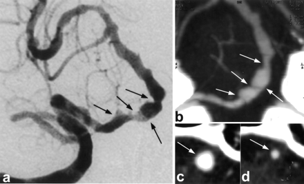 Fig 4.