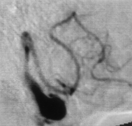 Fig 1.