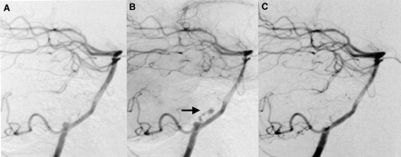 Fig 2.