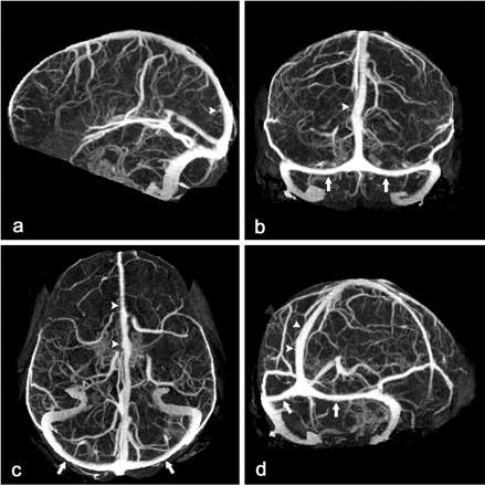 Fig 1.