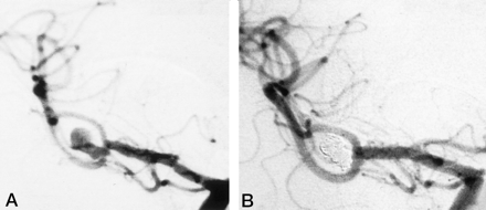 Fig 2.