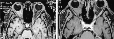 Fig 3.