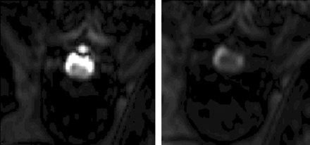Fig 4.