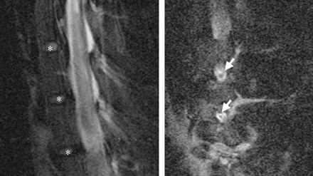 Fig 6.