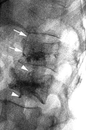 Fig 2.