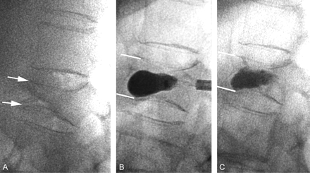 Fig 3.