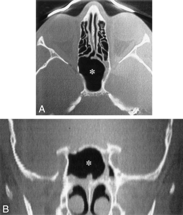 Fig 4.