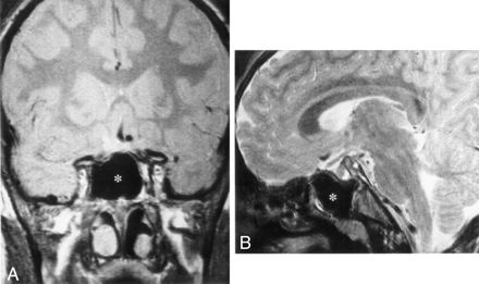 Fig 5.