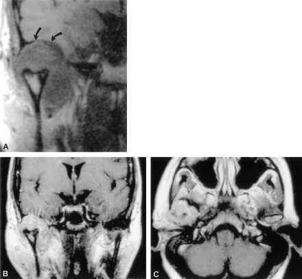 Fig 2.