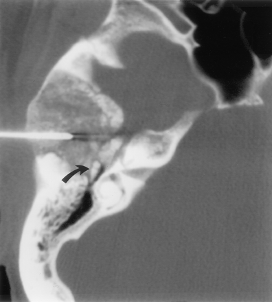 Fig 3.