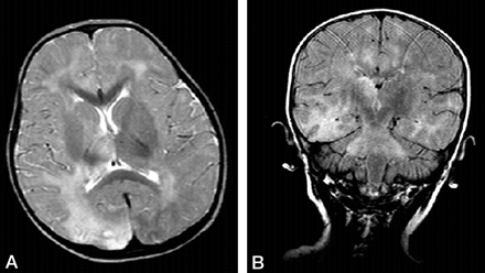 Fig 1.