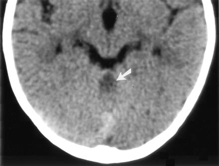 Fig 2.
