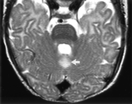 Fig 3.