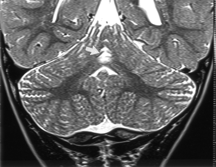 Fig 4.