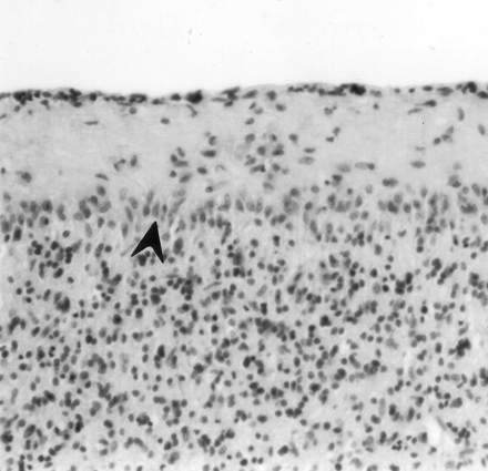 Fig 6.