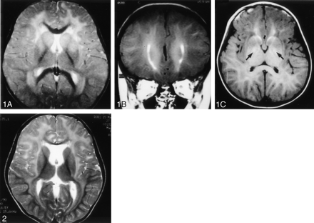 Fig 2.