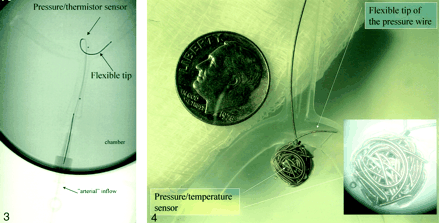 Fig 3.