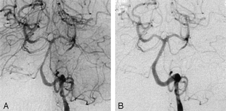 Fig 3.