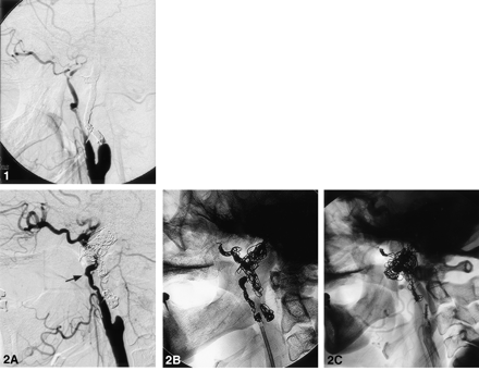 Fig 2.