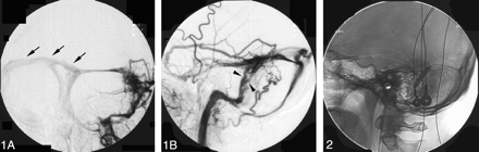 Fig 1.