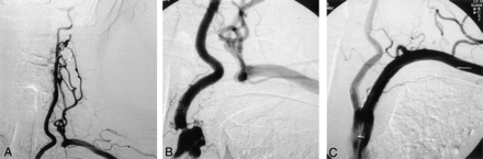 Fig 2.